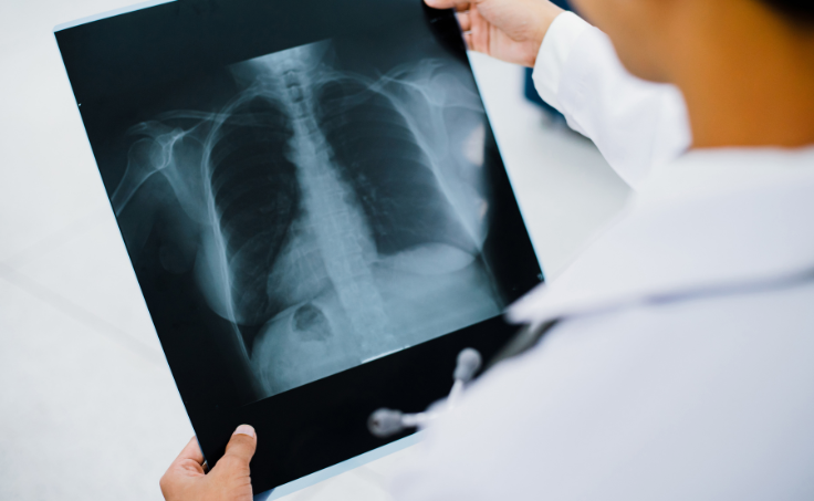 unendo-fp-imagen-diagnostico-medicina-nuclear